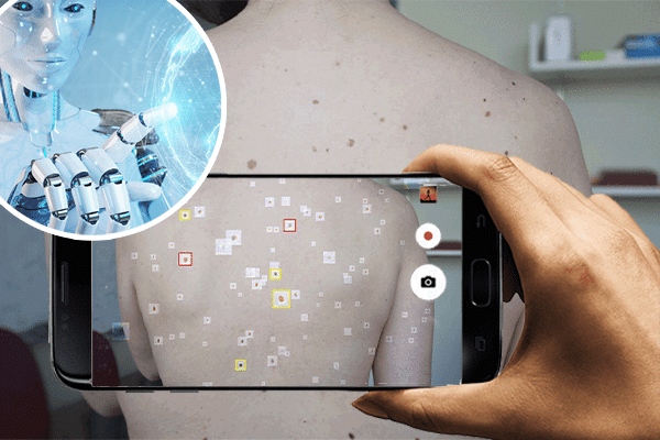 ai cancer detection: skin